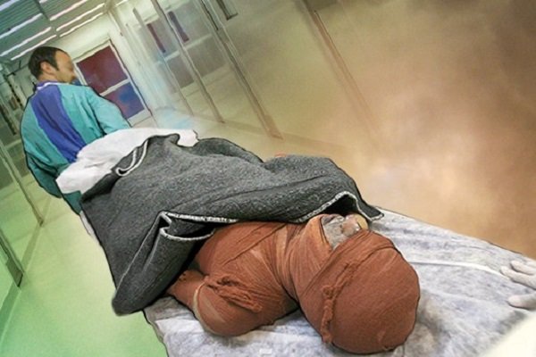 ۳ نفر از مصدومان حادثه آتش‌سوزی «آلنی» فوت شدند